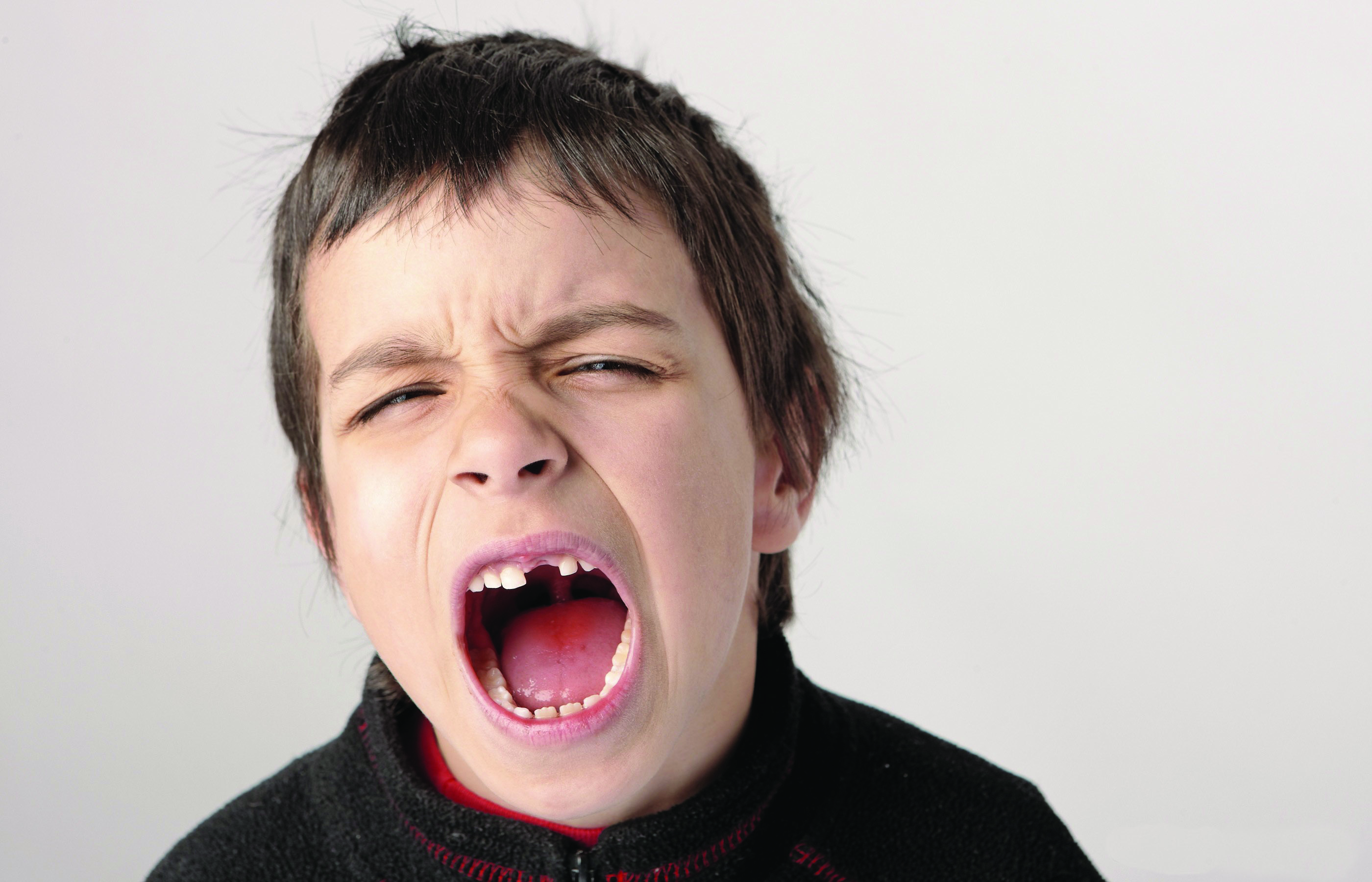Childhood Tooth Injuries:  Protecting Your Child’s Teeth.  By Jean G. You, DDS